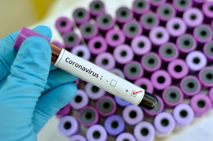 Secretária de Saúde esclarece terceiro caso de coronavírus em ...