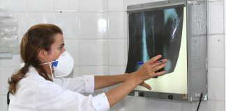 Brusque registrou mais de 250 casos de tuberculose nos últimos anos