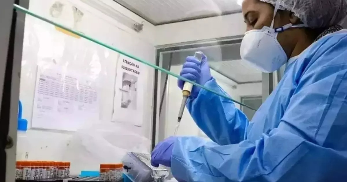 Confirmada primera muerte por viruela del simio en Santa Catarina